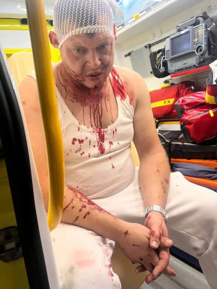 Physical attack in Kożuchów