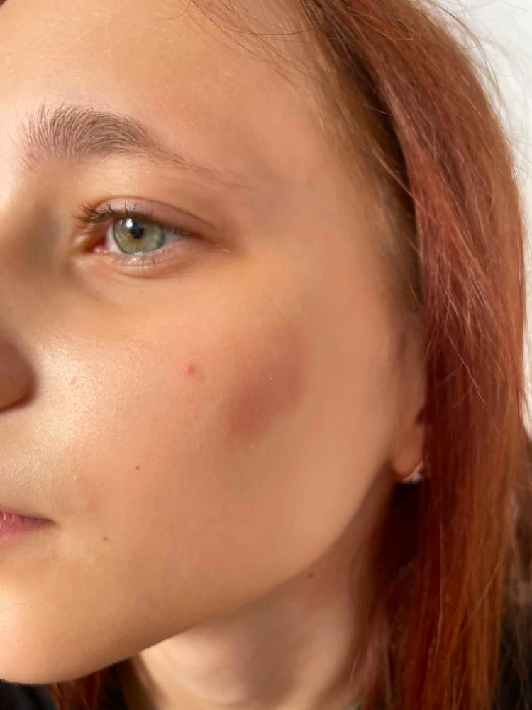 Physical attack in Legnica