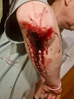 Physical attack in Warszawa