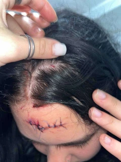 Physical attack in Gdańsk