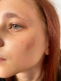 Physical attack in Legnica